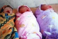 Seorang Ibu Warga Desa Senaung Melahirkan Kembar Tiga