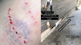 Luka yang dialami Bella dan Kronologis Kejadian yang digambarkan Bella saat diserang Ular. FOTO : Bella