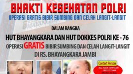 Polda Jambi dan RS Bhayangkara Adakan Operasi Bibir Sumbing dan Celah Langit-langit Gratis