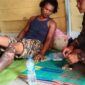 Satu Rumah di Desa Sungai Paur Terbakar, Kaki Pemilik Ikut Tersambar Api