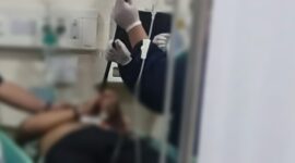 Kanit Resmob Polda Jambi Ditikam Pelaku DPO Curas & Curat dengan Tombak