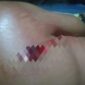 Tangan Korban Luka Dibacok Oleh Orang Diduga Begal. FOTO : Ist