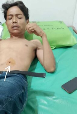 Jadi Korban Curas, Seorang Warga Parit Atong Tanjab Barat Alami Luka Tusuk dan Bacok