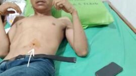 Ari Korban Tindak Pidana Curas mengalami luka tusuk. (Humas)