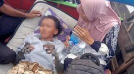 Derza Alami Luka Bakar Kebakaran di Dusun Teladan Desa Sungai Dualap.