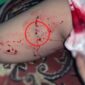 Foto : Tangkapan layar kaki warga yang digigit Ular.