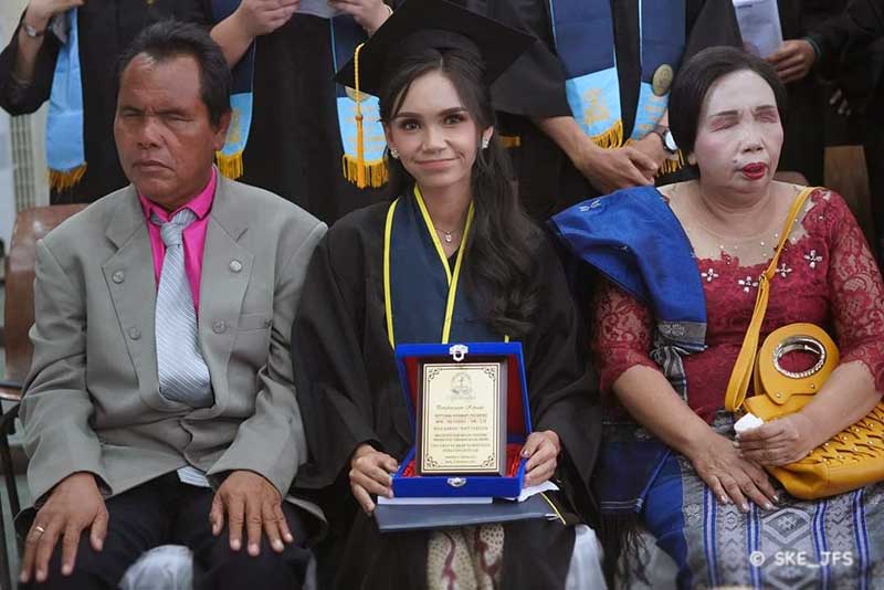 Septiana Hirawati Pasaribu anak dari pasangan tuna netra sukses meraih predikat Cumlaude dari Universitas HKBP Nommensen Pematangsiantar. [FOTO : Gunawan Hutajulu]
