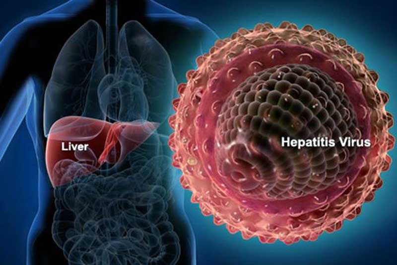 Ilustrasi Kasus Hepatitis Akut